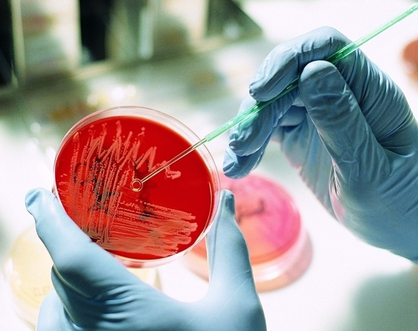 �o(w��)Ѫ�弚(x��)�����B(y��ng)